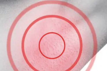 간수치가 높으면 나타나는 증상 33