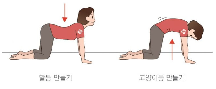 일자허리 원인