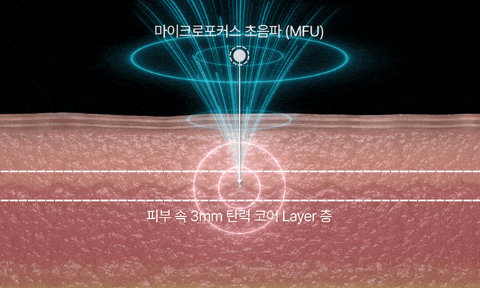 홈 뷰티 디바이스