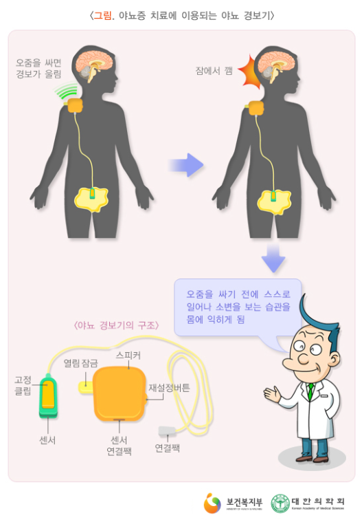 소아야뇨증