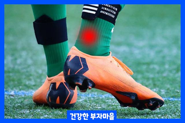 발목 염좌 증상은 발목이 붓는 이유 중 가장 많은 비중을 차지