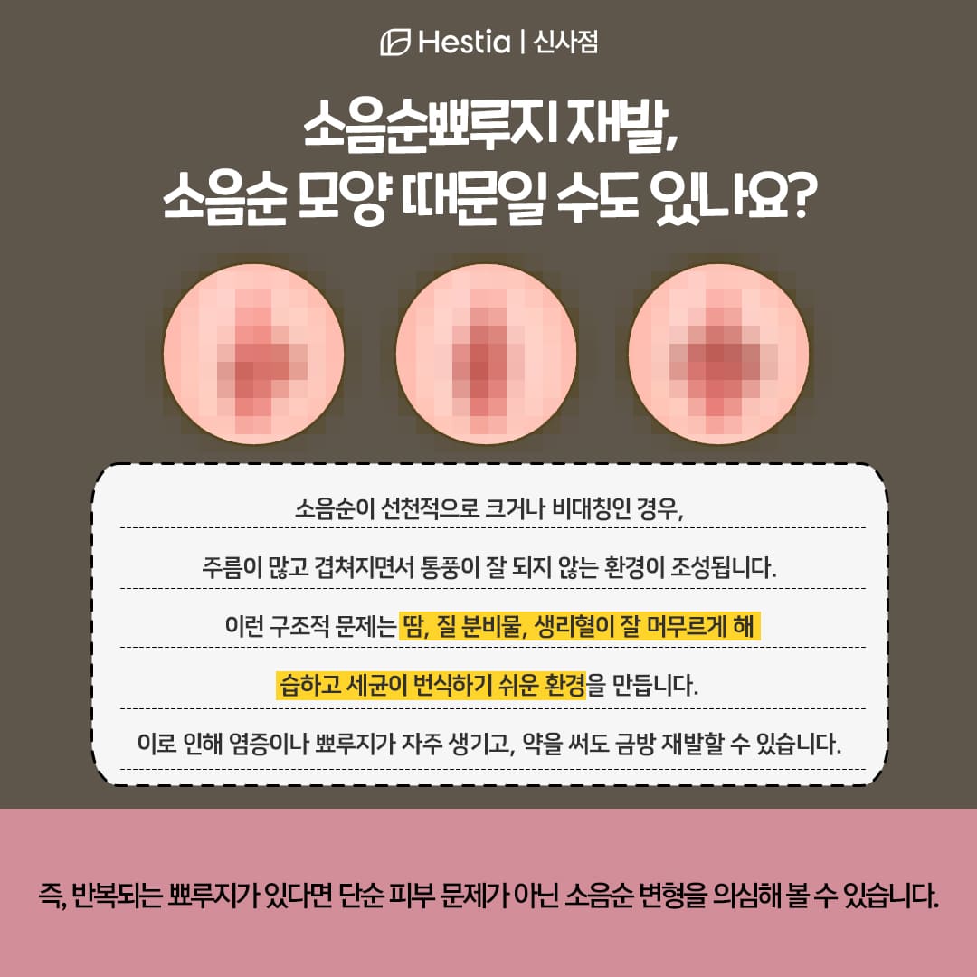 소음순뾰루지, 구조적인 문제 때문일 수 있을까요?