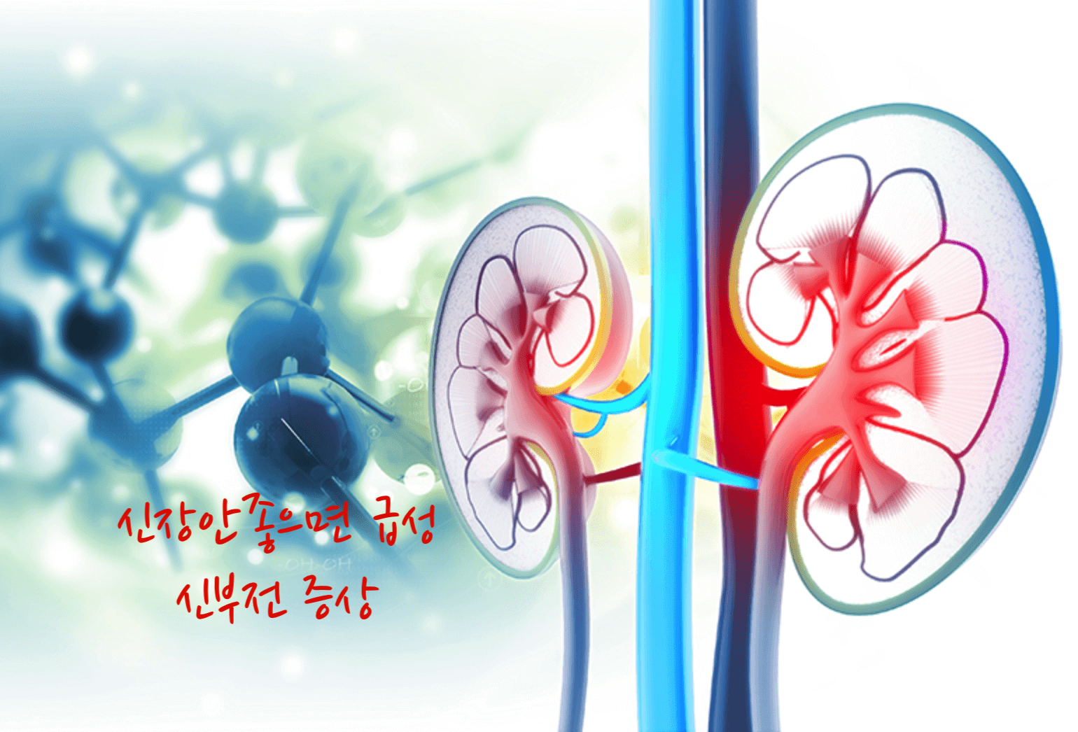 신장 안좋으면