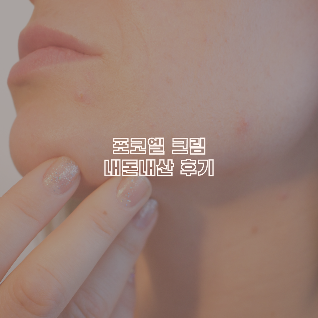 포코엘 크림 내돈내산 후기 부작용 정보