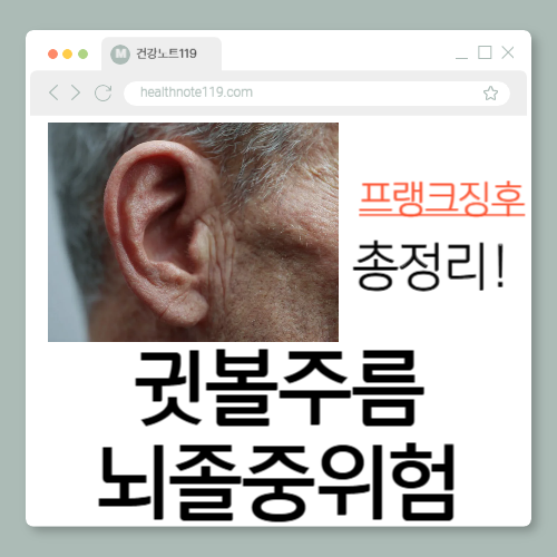 프랭크징후 총정리: 귓볼주름과 뇌졸중 위험은 연결될까?