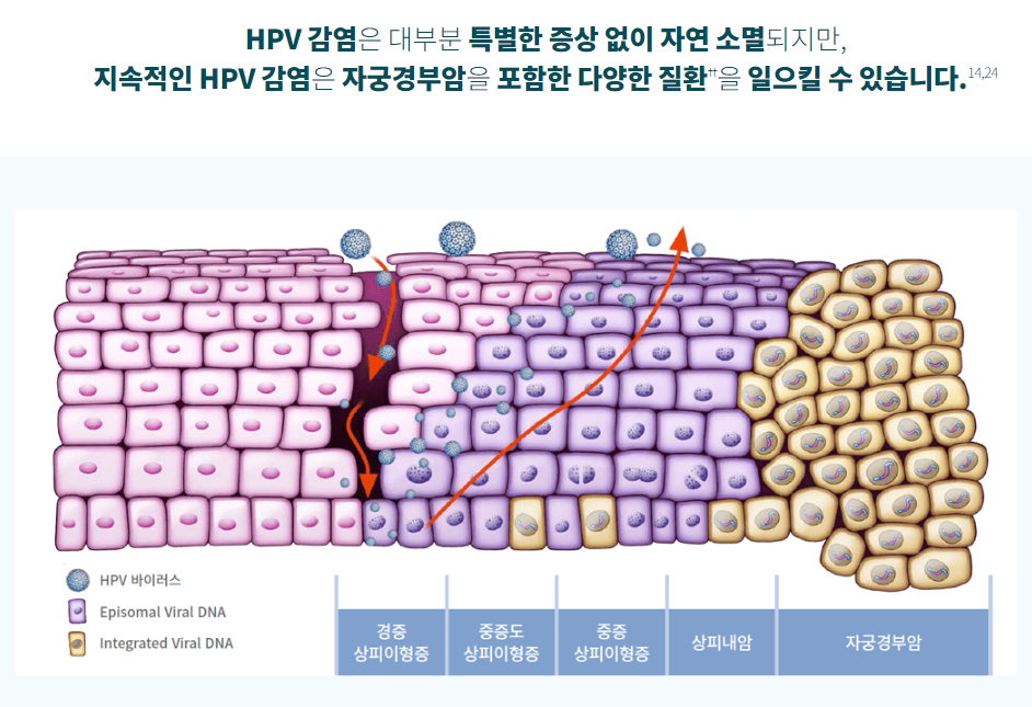 자궁경부암을-유발하는-HPV-감염