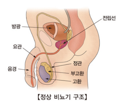 전립선비대증