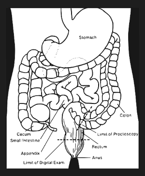대장내시경비용,검사시간-이미지