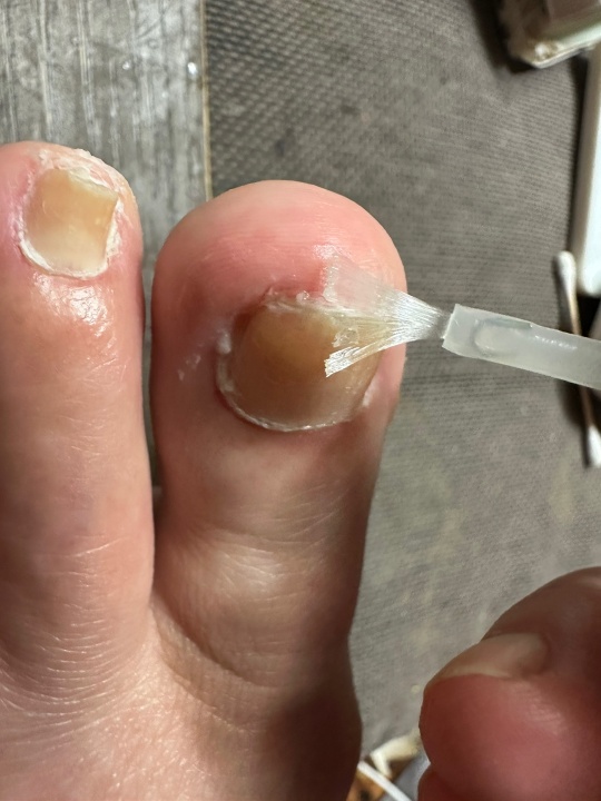 집에서 꾸준히 관리하는 방법