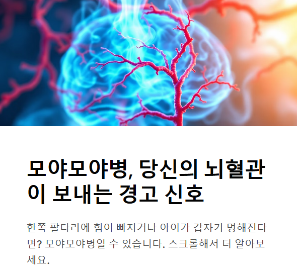 모야모야병이란? 초기 증상과 원인 총정리