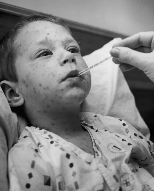 대상포진 예방접종 가격