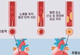 콜레스테롤 낮추는법 총정리: 식단&middot;운동&middot;체중 관리 핵심 가이드 참고 이미지 2