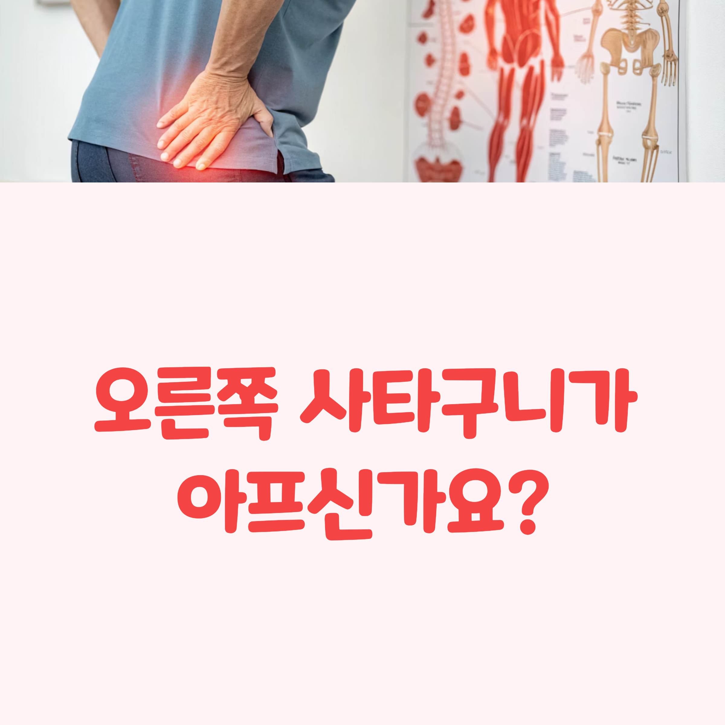 오른쪽 사타구니 안쪽 통증의 5가지 숨은 원인과 자가진단법