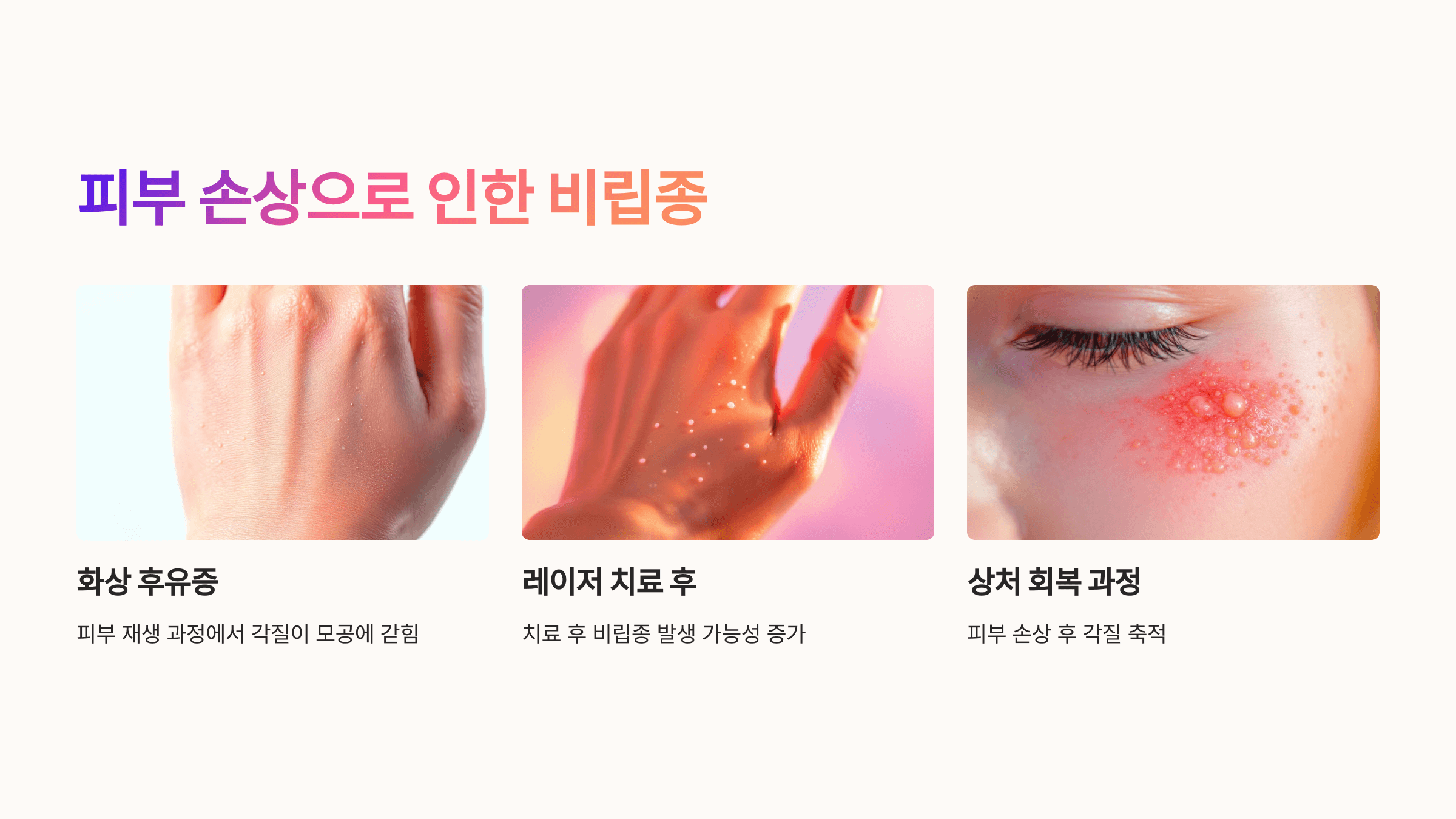 비립종과 관련된 사진입니다.