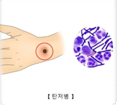 탄저균