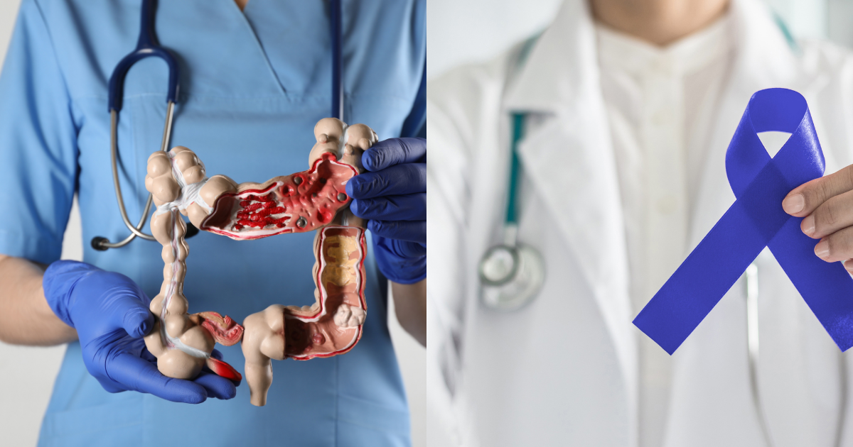 대장모형을 들고 있는 의사와 파란리본을 들고있는 의사와 손