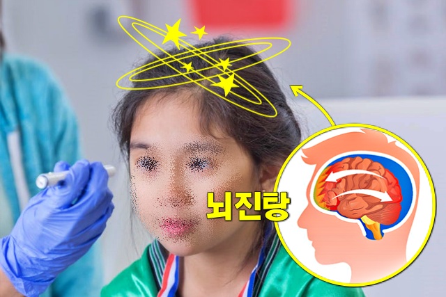 별이 보이는 증상 뇌진탕 초기증상, 뇌진탕 증상, 건강 팁줌 매일꿀정보