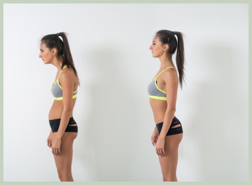 골반 전방경사 증상