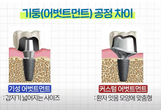 기성 어벗트먼트와 커스텀 어벗트먼트 공정 차이