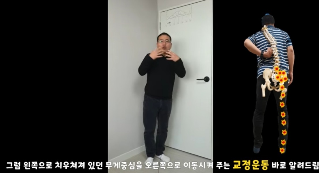 하지방사통-교정운동