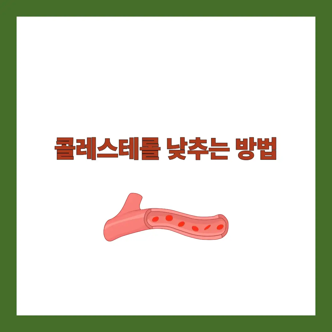 콜레스테롤 낮추는 방법