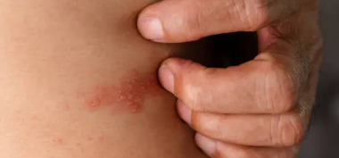 대상포진 예방접종 가격