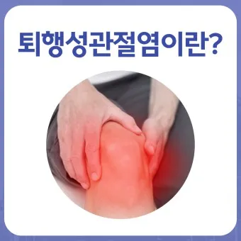 관절염에 좋은 음식 TOP 10_21