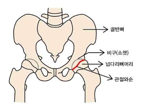 골반뼈