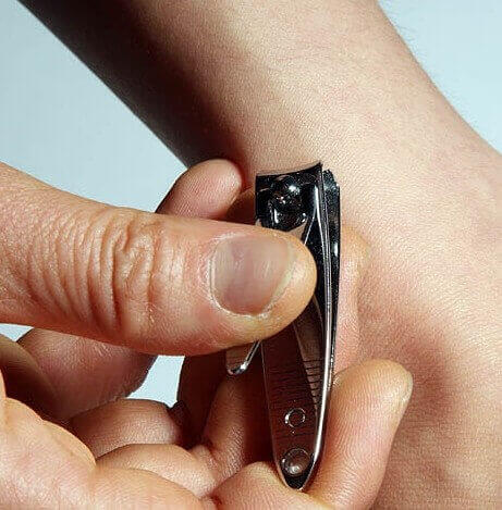 쥐젖을 손톱깎기로 제거 중