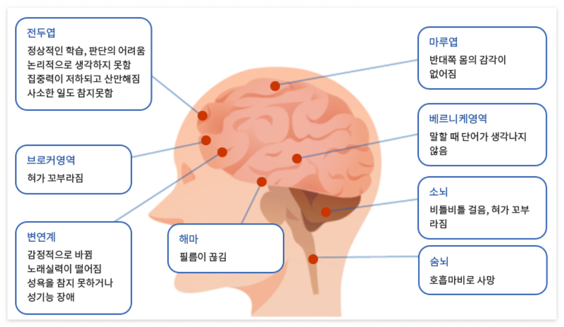술 1급 발암물질