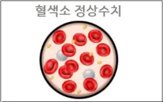 혈색소 정상수치