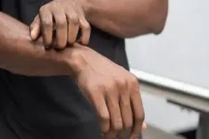가려움