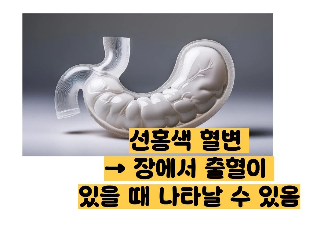 위장관 출혈 증상