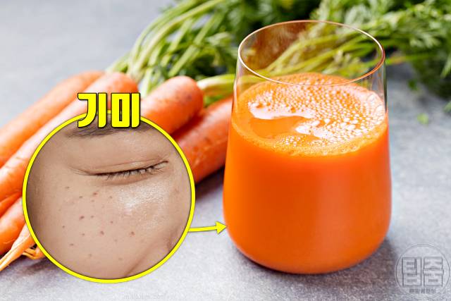 기미 제거 음식 천연 기미치료제 식품 당근 베타카로틴
