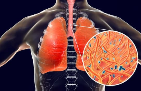 감기 증상 빨리 낫는 법