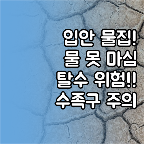 수족구 입안 물집으로 물 못 마시면 ..