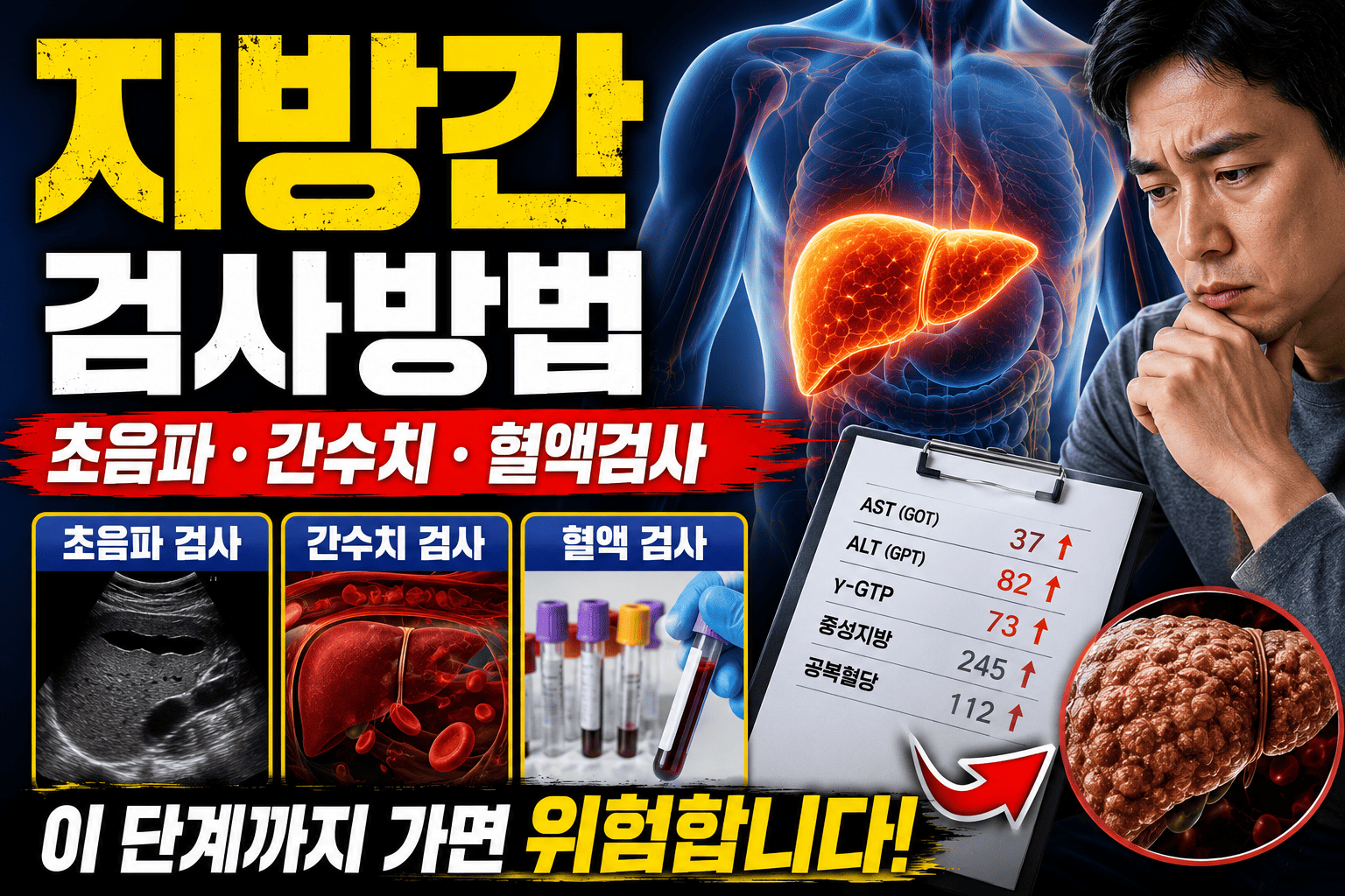지방간 검사방법 (초음파, 간수치, 혈액검사)