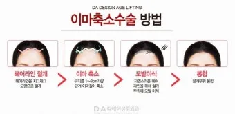 이마가 넓은 여자 관상 특징과 해석_11