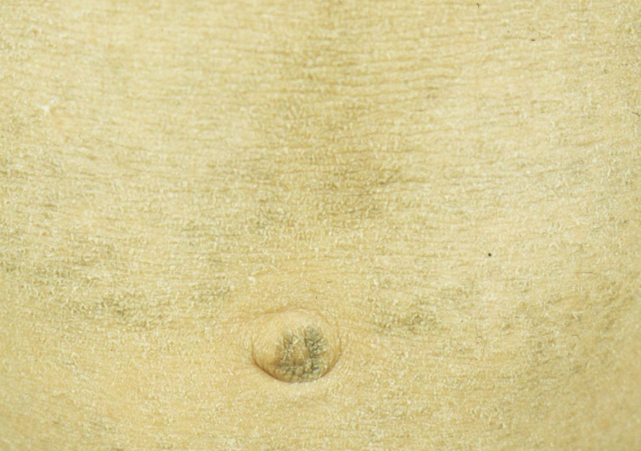 어린선 복부 증상