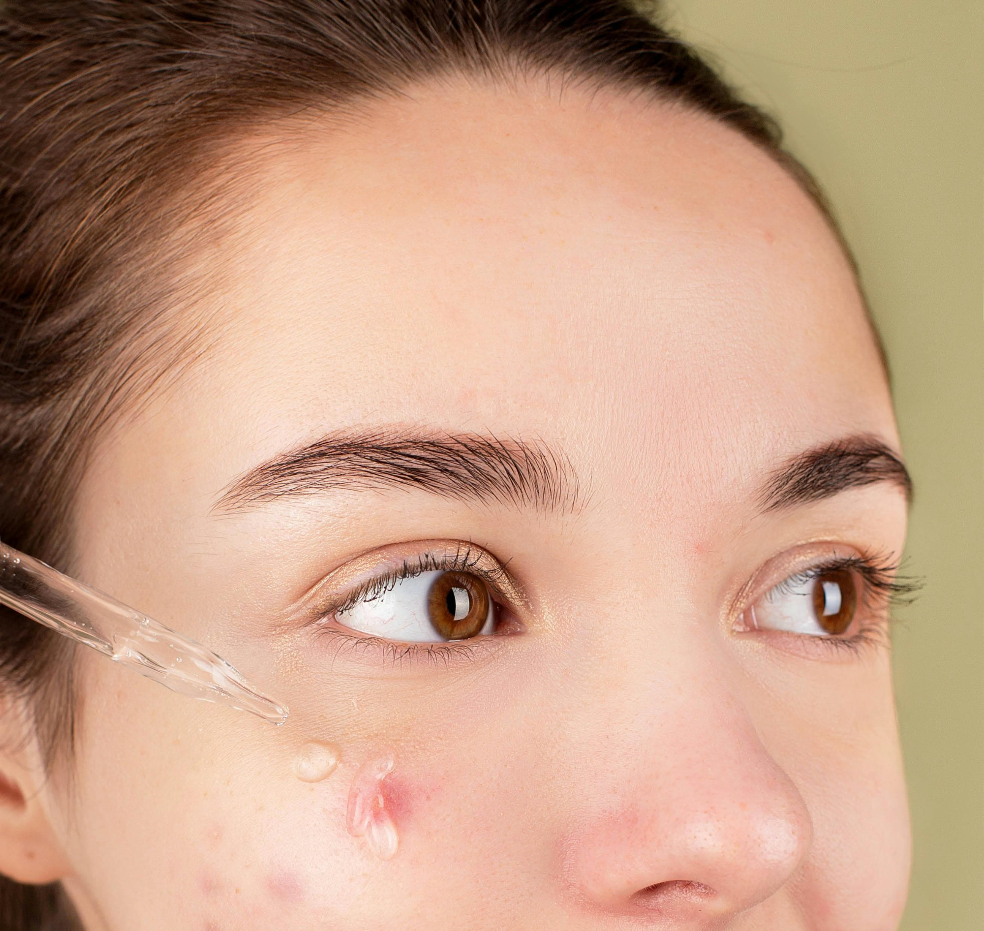 털털한 피부? 아니죠, &lsquo;모낭염&rsquo;입니다: 증상부터 치료까지