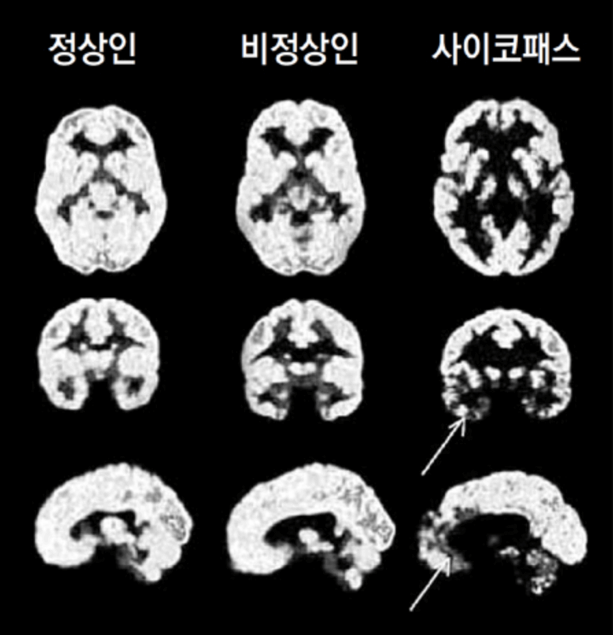 사이코패스 vs 소시오패스, 사이코패스 자가진단 테스트