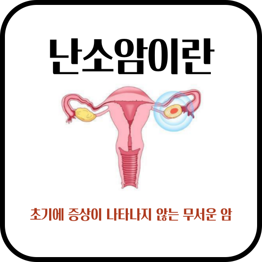 난소암