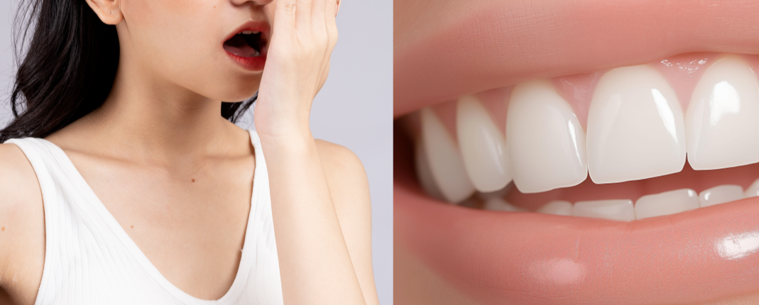 입 냄새를 걱정하며 손으로 입을 가리는 젊은 여성과 깨끗한 치아 이미지 - 구강 건강과 입 냄새 원인 관련 이미지