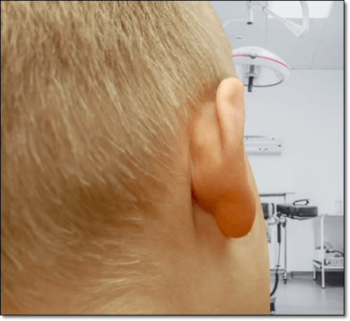 이관개방증 남자