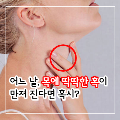 갑상선암 증상과 자가진단 방법