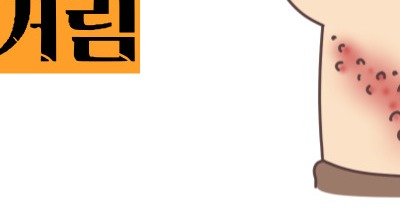 대상포진 초기증상