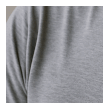 콜린성 두드러기