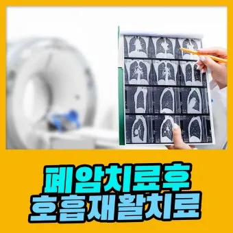 폐암 면역항암제 치료비 절반으로 줄이는 보험 활용 전략으로 실전팁_11