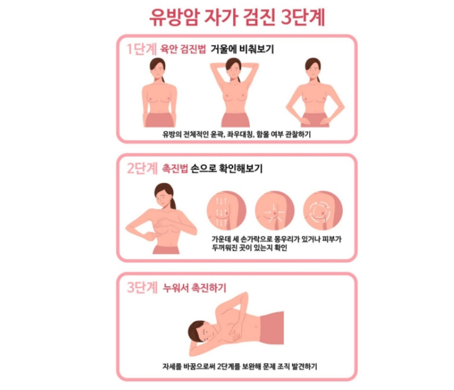 유방암을 자가로 진단을 할 수 있는 3단계 방법을 그림으로 그려서 나타낸 사진