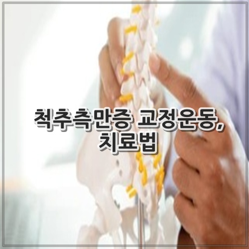 척추측만증 교정운동, 치료법